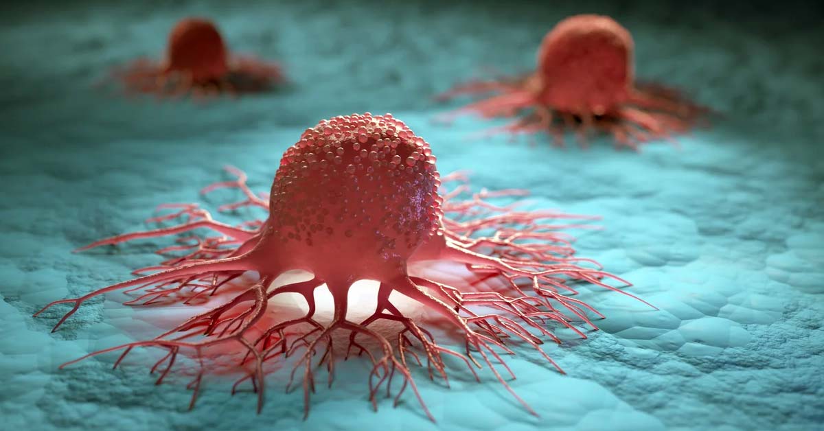 Cancer Cells are now being Tricked into Consuming Toxic Drug by Using Nanotechnology